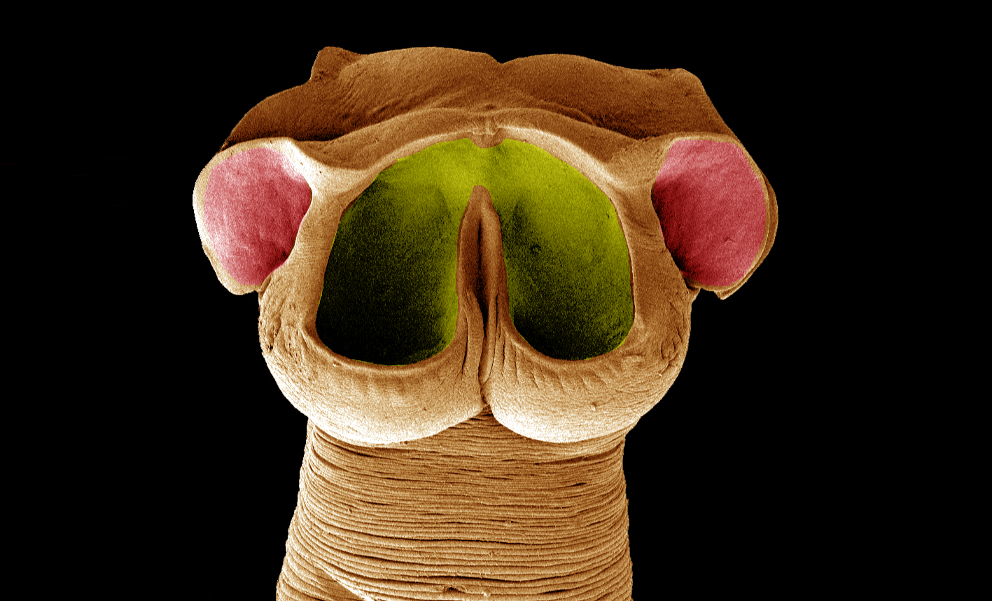 Tasemnice Tetrabothrius sp. získaná z racka na Svalbardu. Foto Roman Kuchta