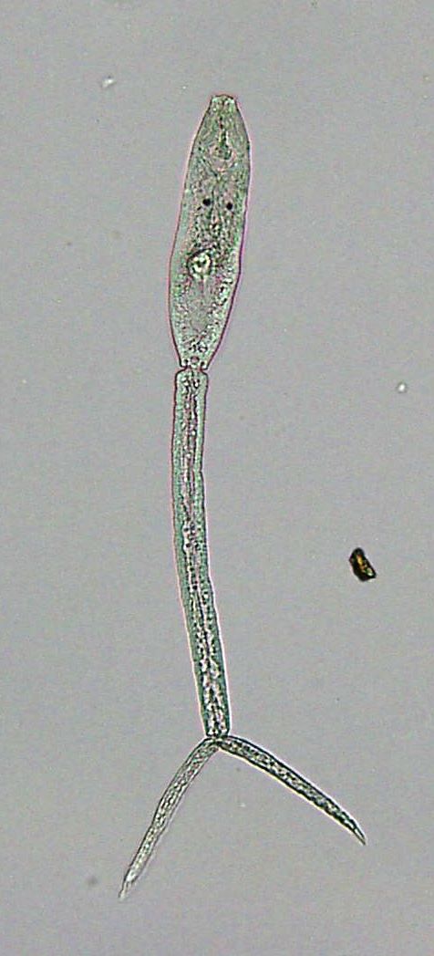 Cca 0,5 mm velká cerkárie, která napadá kůži plavců (Trichobilharzia sp.). Foto Jindřich Duras